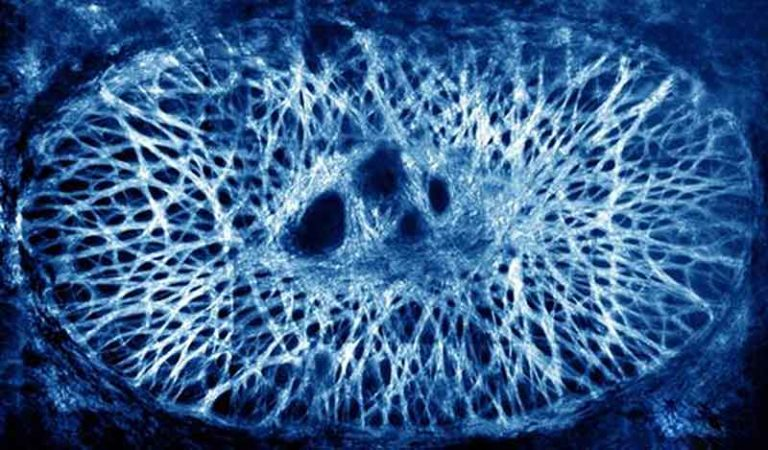 Lamina-Cribrosa-SHG-1-768×450