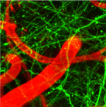 Multiphoton-Image Multiphoton-Image